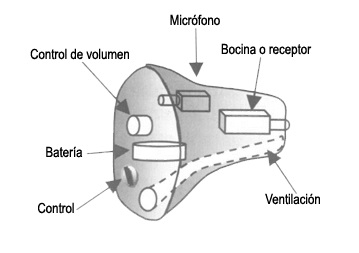 COMPOSICION-AUDIFONO-INTRACANAL